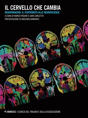 cover image of Il cervello che cambia